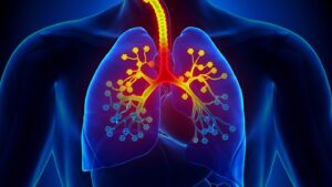 cs-asthma-surprising-symptoms-01-1440x810